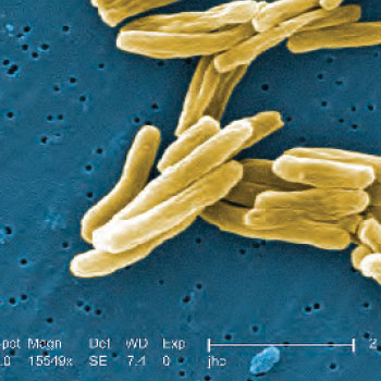 Image of tuberculosis