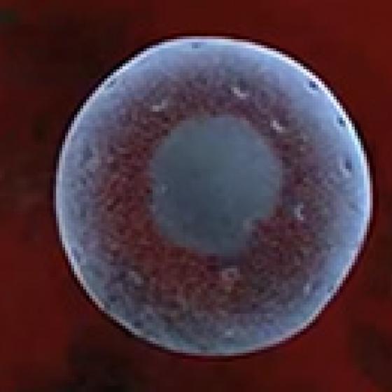 Video thumbnail image for Nucleolus 3-D