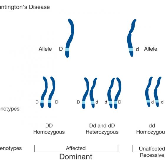 Huntington's disease illustration